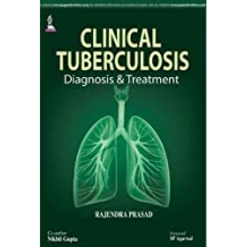 Туберкулез книга. Tuberculosis книга. Книга по фтизиатрии. Tuberculosis diagnosis. Книга по туберкулезу читать.